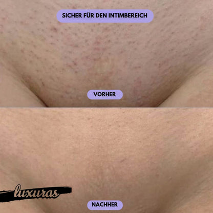 Luxuras™ Kristall-Haar-Radiergummi